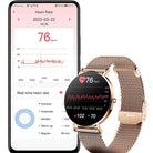 AllyWatch-The watch that connects the woman to her elegance.