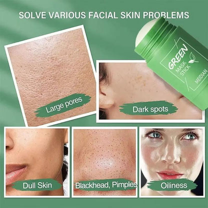acne and blackhead remover